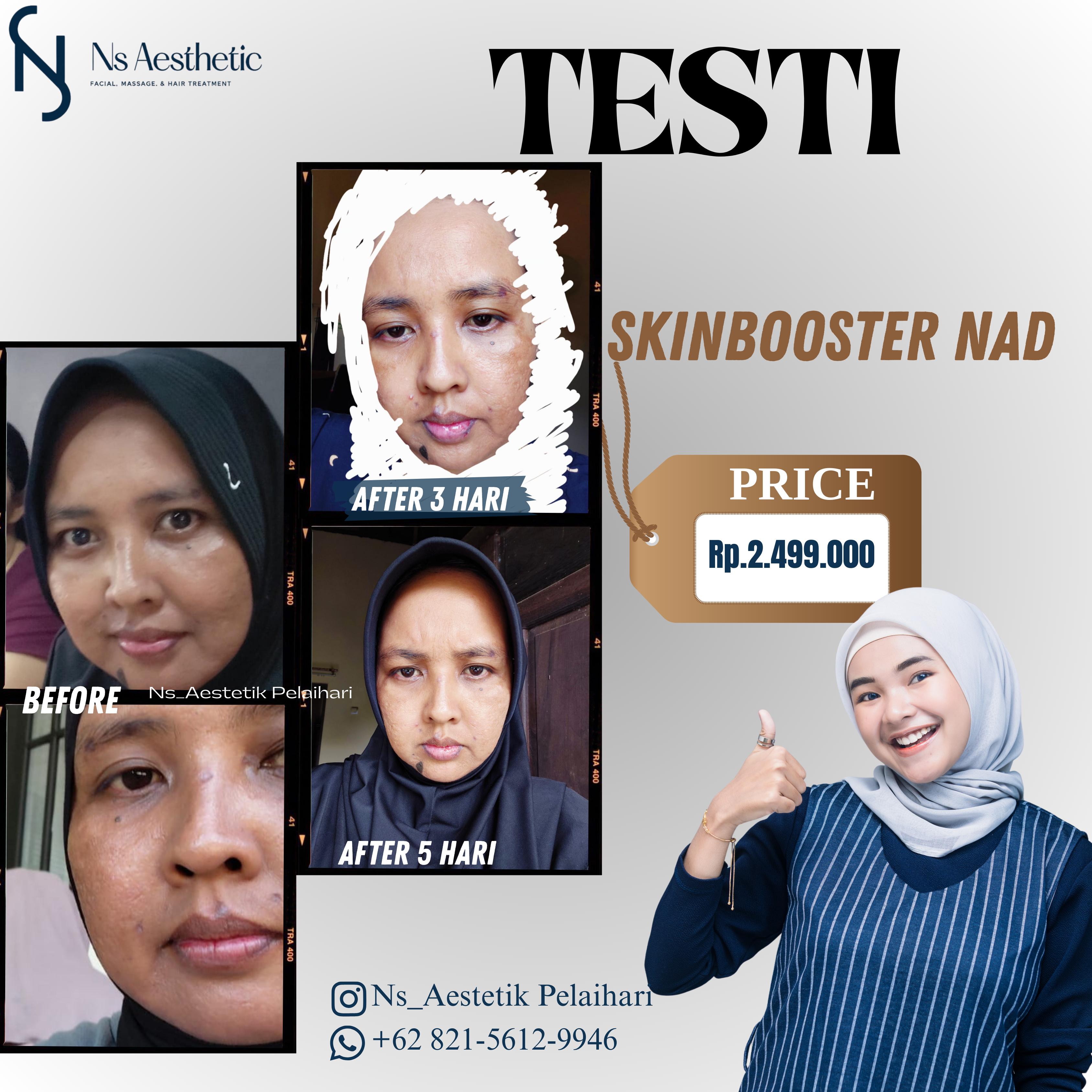 Hasil Devi Anggraeni